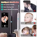 Otoscope Nettoyeur d'Oreilles avec Caméra HD